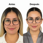 Gomas de Resveratrol